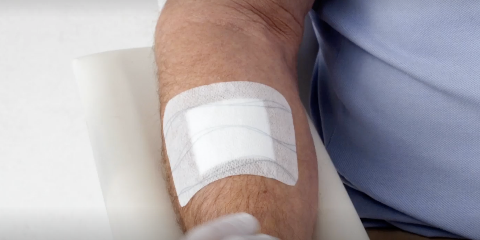 Hypafix skin sensitive’s easy application, fixation, and removal